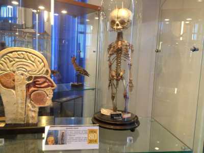 Il reperto di un feto umano conservato nella sezione dedicata all'anatomia